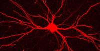 A microscope image of a nerve cell and its many branches (or dendrites) in a deep layer of a rat's cerebral cortex.